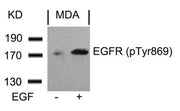 Western blot analysis of extracts from MDA cells untreated or treated with EGF using EGFR(Phospho-Tyr869) Antibody.
