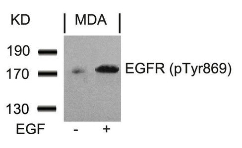 Western blot analysis of extracts from MDA cells untreated or treated with EGF using EGFR(Phospho-Tyr869) Antibody.