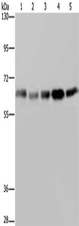 Gel: 6%SDS-PAGE, Lysate: 40 ug, Lane 1-5: Raji cells, 293T cells, LoVo cells, Hela cells, K562 cells, Primary antibody: CSB-PA184930(GNL3 Antibody) at dilution 1/300, Secondary antibody: Goat anti rabbit IgG at 1/8000 dilution, Exposure time: 5 se...