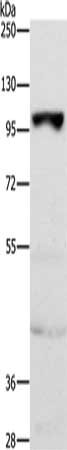 Gel: 10%SDS-PAGE, Lysate: 40 ug, Lane: Mouse heart tissue, Primary antibody: CSB-PA184937(TRPM5 Antibody) at dilution 1/850, Secondary antibody: Goat anti rabbit IgG at 1/8000 dilution, Exposure time: 5 seconds