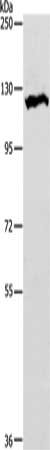 Gel: 8%SDS-PAGE, Lysate: 60 ug, Lane: HT29 cells, Primary antibody: CSB-PA185075(NOTCH1 Antibody) at dilution 1/300, Secondary antibody: Goat anti rabbit IgG at 1/8000 dilution, Exposure time: 1 minute
