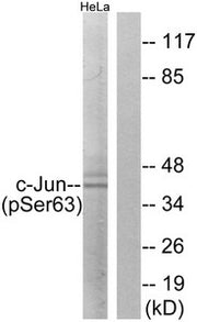 Western blot analysis of extracts from HeLa cells using c-Jun (Phospho-Ser63) Antibody.The lane on the right is treated with the antigen-specific peptide.