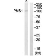 Western blot analysis of extracts from JK cells, using PHLDA3 antiobdy.