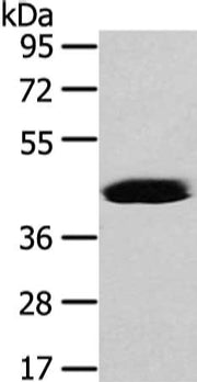 Gel: 8%SDS-PAGE, Lysate: 40 ug, Lane: Hela cell, Primary antibody: CSB-PA185487(VASH2 Antibody) at dilution 1/450 dilution, Secondary antibody: Goat anti rabbit IgG at 1/8000 dilution, Exposure time: 40 seconds