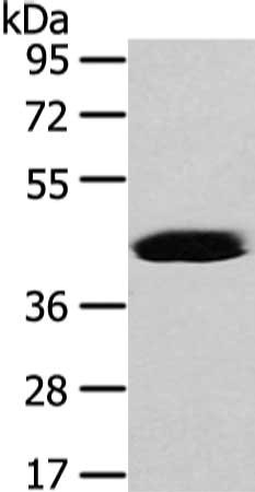 Gel: 8%SDS-PAGE, Lysate: 40 ug, Lane: Hela cell, Primary antibody: CSB-PA185487(VASH2 Antibody) at dilution 1/450 dilution, Secondary antibody: Goat anti rabbit IgG at 1/8000 dilution, Exposure time: 40 seconds