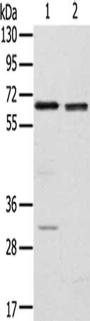 Gel: 8%SDS-PAGE, Lysate: 60 ug, Lane 1-2: HT29 cells, hela cells, Primary antibody: CSB-PA185517(RBBP5 Antibody) at dilution 1/200, Secondary antibody: Goat anti rabbit IgG at 1/8000 dilution, Exposure time: 10 seconds
