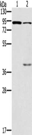Gel: 6%SDS-PAGE, Lysate: 40 ug, Lane 1-2: Mouse kidney tissue, Mouse brain tissue, Primary antibody: CSB-PA185605(CNGA3 Antibody) at dilution 1/500, Secondary antibody: Goat anti rabbit IgG at 1/8000 dilution, Exposure time: 1 minute