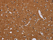 The image on the left is immunohistochemistry of paraffin-embedded Human brain tissue using CSB-PA185718(KLK13 Antibody) at dilution 1/20, on the right is treated with fusion protein. (Original magnification: ×200)