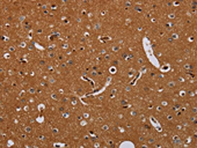 The image on the left is immunohistochemistry of paraffin-embedded Human brain tissue using CSB-PA185718(KLK13 Antibody) at dilution 1/20, on the right is treated with fusion protein. (Original magnification: ×200)