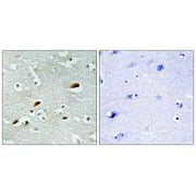 Immunohistochemistry analysis of paraffin-embedded human brain tissue, using TIP60 antibody.