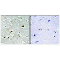 Immunohistochemistry analysis of paraffin-embedded human brain tissue, using TIP60 antibody.