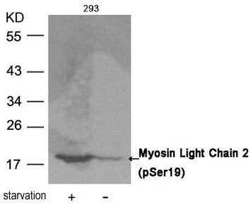Western blot analysis of extracts from 293 cells untreated or treated with starvation using Myosin Light Chain 2 (Phospho-Ser19) Antibody.