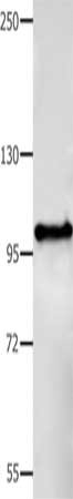Gel: 8%SDS-PAGE, Lysate: 40 ug, Lane: Mouse stomach tissue, Primary antibody: CSB-PA186525(BCOR Antibody) at dilution 1/350, Secondary antibody: Goat anti rabbit IgG at 1/8000 dilution, Exposure time: 40 seconds