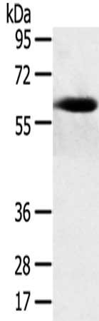 Gel: 8%SDS-PAGE,Lysate: 40 ug,,Primary antibody: CSB-PA186712(SPATA18 Antibody) at dilution 1/250 dilution,Secondary antibody: Goat anti rabbit IgG at 1/8000 dilution,Exposure time: 5 minutes