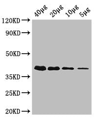 Western Blot Positive WB detected in: Rosseta bacteria lysate at 40µg, 20µg, 10µg, 5µg All lanes: rbsK antibody; HRP conjugated at 0.42µg/ml Predicted band size: 33 kDa Observed band size: 40 kDa