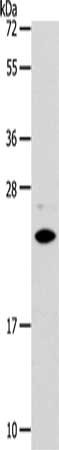 Gel: 12%SDS-PAGE, Lysate: 40 ug, Lane: Mouse liver tissue, Primary antibody: CSB-PA187305(SOD2 Antibody) at dilution 1/950, Secondary antibody: Goat anti rabbit IgG at 1/8000 dilution, Exposure time: 30 seconds