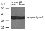 Western blot analysis of extract from rat brain and mouse brain using synaptophysin 2 Antibody.