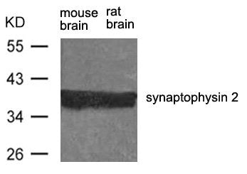 Western blot analysis of extract from rat brain and mouse brain using synaptophysin 2 Antibody.