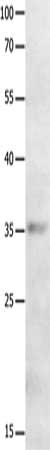 Gel: 10%SDS-PAGE, Lysate: 40 ug, Lane: Human leiomyosarcoma tissue, Primary antibody: CSB-PA187447(MAGEA2 Antibody) at dilution 1/700, Secondary antibody: Goat anti rabbit IgG at 1/8000 dilution, Exposure time: 30 seconds