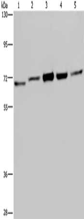 Gel: 6%SDS-PAGE, Lysate: 40 ug, Lane 1-5: MCF7 cells, 293T cells, HT29 cells, Hela cells, Jurkat cells, Primary antibody: CSB-PA187496(CHEK2 Antibody) at dilution 1/150, Secondary antibody: Goat anti rabbit IgG at 1/8000 dilution, Exposure time: 2...