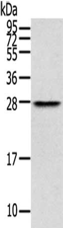 Gel: 12%SDS-PAGE,Lysate: 40 ug,,Primary antibody: CSB-PA187498(THYN1 Antibody) at dilution 1/400 dilution,Secondary antibody: Goat anti rabbit IgG at 1/8000 dilution,Exposure time: 10 seconds