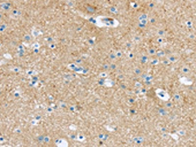 The image on the left is immunohistochemistry of paraffin-embedded Human brain tissue using CSB-PA188240(VAMP1 Antibody) at dilution 1/25, on the right is treated with synthetic peptide. (Original magnification: ×200)