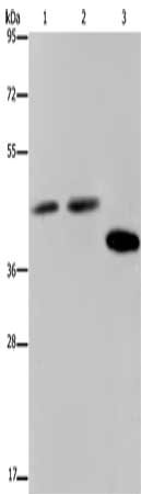 Gel: 8%SDS-PAGE, Lysate: 40 ug, Lane 1-3: Hela cells, 293T cells, LO2 cells, Primary antibody: CSB-PA188248(SERPINB3 Antibody) at dilution 1/400, Secondary antibody: Goat anti rabbit IgG at 1/8000 dilution, Exposure time: 10 seconds