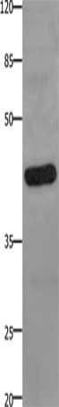 Gel: 10%SDS-PAGE, Lysate: 40 ug, Lane: A549 cells, Primary antibody: CSB-PA189021(PTGER2 Antibody) at dilution 1/100, Secondary antibody: Goat anti rabbit IgG at 1/8000 dilution, Exposure time: 1 minute