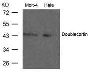 Western blot analysis of extract from Molt-4 and Hela cells using Doublecortin Antibody