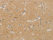 The image on the left is immunohistochemistry of paraffin-embedded Human brain tissue using CSB-PA189423(NDRG1 Antibody) at dilution 1/70, on the right is treated with synthetic peptide. (Original magnification: ×200)