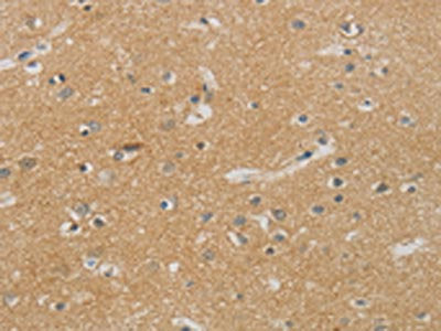 The image on the left is immunohistochemistry of paraffin-embedded Human brain tissue using CSB-PA189423(NDRG1 Antibody) at dilution 1/70, on the right is treated with synthetic peptide. (Original magnification: ×200)
