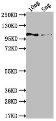 Western Blot Positive WB detected in Recombinant protein All lanes: Genome polyprotein Antibody antibody at 1:2000 Secondary Goat polyclonal to rabbit IgG at 1/50000 dilution Predicted band size: 87.3 kDa Observed band size: 105 kDa