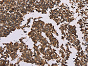 The image on the left is immunohistochemistry of paraffin-embedded Human tonsil tissue using CSB-PA189809(OTC Antibody) at dilution 1/50, on the right is treated with fusion protein. (Original magnification: ×200)