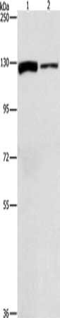 Gel: 6%SDS-PAGE, Lysate: 40 ug, Lane 1-2: A172 cells, PC3 cells, Primary antibody: CSB-PA189814(ACLY Antibody) at dilution 1/1050, Secondary antibody: Goat anti rabbit IgG at 1/8000 dilution, Exposure time: 30 seconds