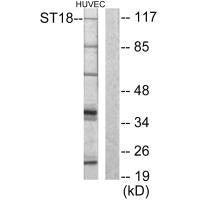 Western blot analysis of extracts from HUVEC cells, using ZNF387 antibody.