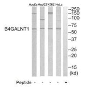 Western blot analysis of extracts from HeLa cells, K562 cells, HepG2 cells and HuvEC cells, using B4GALNT1 antibody.