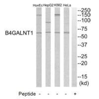 Western blot analysis of extracts from HeLa cells, K562 cells, HepG2 cells and HuvEC cells, using B4GALNT1 antibody.