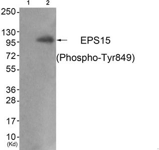 Western blot analysis of extracts from JK cells (Lane 2), using EPS15 (Phospho-Tyr849) Antibody. The lane on the left is treated with antigen-specific peptide.
