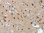 The image on the left is immunohistochemistry of paraffin-embedded Human brain tissue using CSB-PA190109(OPRD1 Antibody) at dilution 1/15, on the right is treated with synthetic peptide. (Original magnification: ×200)