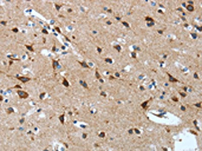 The image on the left is immunohistochemistry of paraffin-embedded Human brain tissue using CSB-PA190109(OPRD1 Antibody) at dilution 1/15, on the right is treated with synthetic peptide. (Original magnification: ×200)
