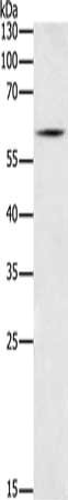 Gel: 10%SDS-PAGE, Lysate: 40 ug, Lane: Mouse heart tissue, Primary antibody: CSB-PA190713(BCL2L13 Antibody) at dilution 1/550, Secondary antibody: Goat anti rabbit IgG at 1/8000 dilution, Exposure time: 30 seconds
