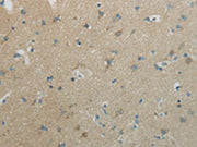 The image on the left is immunohistochemistry of paraffin-embedded Human brain tissue using CSB-PA190943(WNT10B Antibody) at dilution 1/20, on the right is treated with synthetic peptide. (Original magnification: ×200)