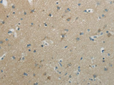 The image on the left is immunohistochemistry of paraffin-embedded Human brain tissue using CSB-PA190943(WNT10B Antibody) at dilution 1/20, on the right is treated with synthetic peptide. (Original magnification: ×200)