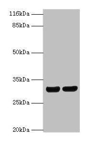 Western blot All lanes: HLA-DRB1 antibody at 2µg/ml Lane 1: A375 whole cell lysate Lane 2: Raji whole cell lysate Secondary Goat polyclonal to rabbit IgG at 1/10000 dilution Predicted band size: 30 kDa Observed band size: 30 kDa