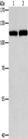 Gel: 8%SDS-PAGE, Lysate: 40 ug, Lane 1-2: Raji cells, K562 cells, Primary antibody: CSB-PA191967(TLR3 Antibody) at dilution 1/500, Secondary antibody: Goat anti rabbit IgG at 1/8000 dilution, Exposure time: 20 seconds