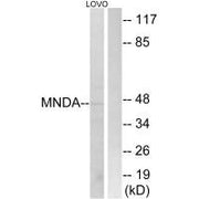Western blot analysis of extracts from LOVO cells, using MNDA antibody.