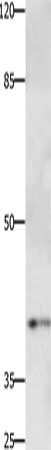 Gel: 10%SDS-PAGE, Lysate: 40 ug, Lane: Jurkat cells, Primary antibody: CSB-PA192779(PTGER1 Antibody) at dilution 1/500, Secondary antibody: Goat anti rabbit IgG at 1/8000 dilution, Exposure time: 2 minutes