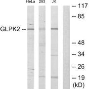 Western blot analysis of extracts from HeLa cells, 293 cells and Jurkat cells, using GLPK2 antibody.