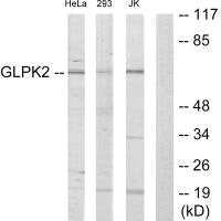 Western blot analysis of extracts from HeLa cells, 293 cells and Jurkat cells, using GLPK2 antibody.