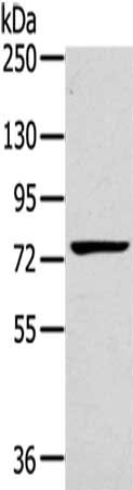 Gel: 6%SDS-PAGE,Lysate: 40 ug,,Primary antibody: CSB-PA193087(RHOBTB1 Antibody) at dilution 1/200 dilution,Secondary antibody: Goat anti rabbit IgG at 1/8000 dilution,Exposure time: 1 minute